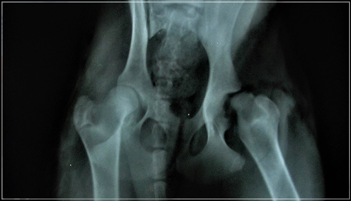 Radiografia1